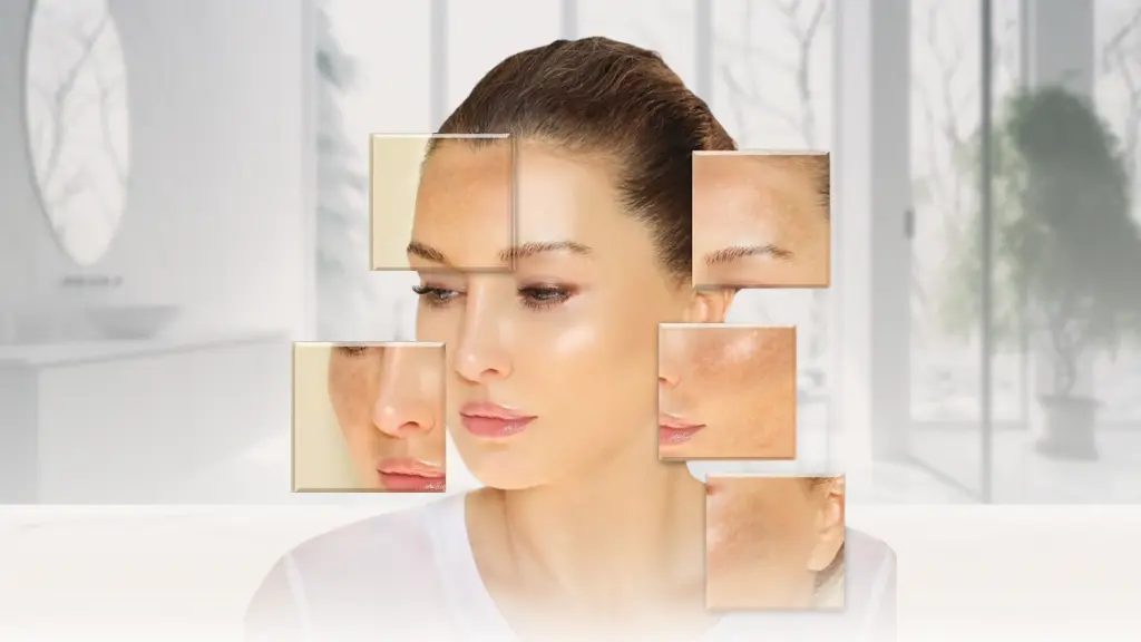 How to Treat Hyperpigmentation: Best Skincare Ingredients