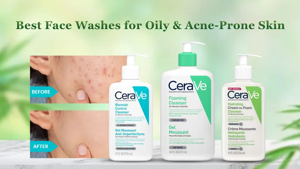 Best Face Washes for Oily & Acne-Prone Skin in Sri Lanka (2026)